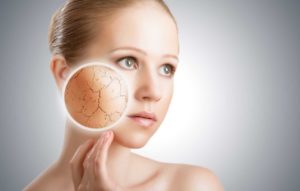 Tips Merawat Kulit Kering