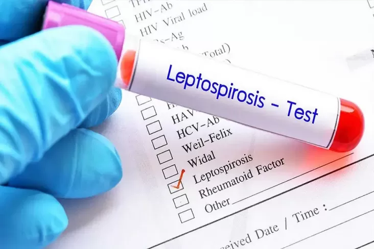 6 Nelayan Tewas Misterius, Diduga Akibat Leptospirosis