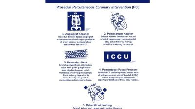 Mengenal gejala lalu juga prosedur PCI untuk serangan jantung akut