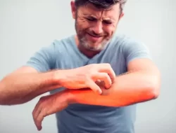 5 Ciri-ciri Gatal lantaran Diabetes, Jangan Asal Garuk