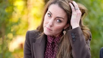 Mengenal Terapi Topi Dingin, Cara Kate Middleton Atasi Rambut Rontok selama Perawatan Kanker?