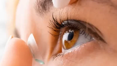Mengerikan! Dokter Temukan 27 Lensa Kontak di Mata Wanita Hal ini