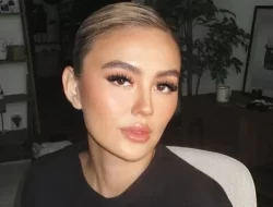 Mengenal Alopecia Areata, Penyakit yang digunakan Menjangkit Agnez Mo hingga Alami Kebotakan