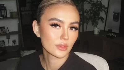 Mengenal Alopecia Areata, Penyakit yang digunakan Menjangkit Agnez Mo hingga Alami Kebotakan